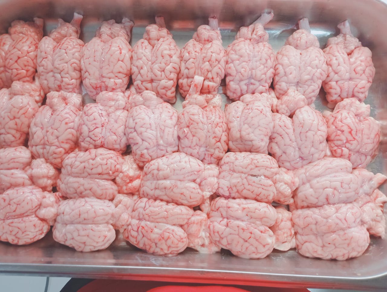 Fresh Brain